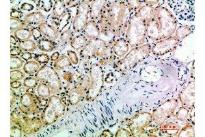 Immunohistochemical analysis of paraffin-embedded human-kidney, antibody was diluted at 1:200