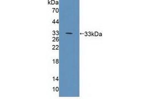 Figure. (CD19 anticorps  (AA 19-287))