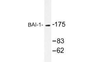 Image no. 1 for anti-Brain-Specific Angiogenesis Inhibitor 1 (BAI1) antibody (ABIN317742) (BAI1 anticorps)