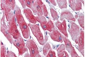 Human Heart: Formalin-Fixed, Paraffin-Embedded (FFPE)