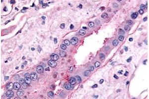 Anti-SLC5A2 antibody  ABIN1049344 IHC staining of human kidney, collecting duct.