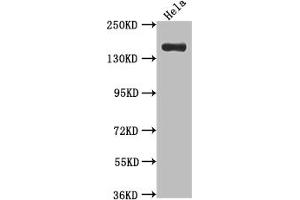 Western Blot Positive WB detected in: Hela whole cell lysate All lanes: Xanthine Oxidase antibody at 1:1000 Secondary Goat polyclonal to rabbit IgG at 1/50000 dilution Predicted band size: 147 kDa Observed band size: 147 kDa (Recombinant XDH anticorps)