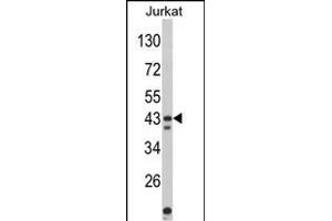 Western blot analysis of CECR5 Antibody (Center) (ABIN652500 and ABIN2842336) in Jurkat cell line lysates (35 μg/lane). (CECR5 anticorps  (AA 164-190))