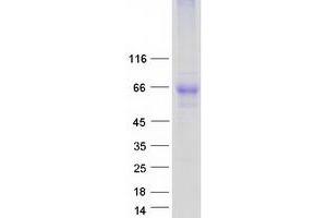 Validation with Western Blot