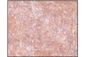 Immunohistochemistry of JMJD8 in mouse spleen tissue with this product at 2. (JMJD8 anticorps  (C-Term))