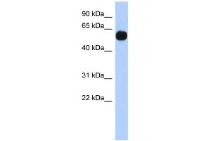 WB Suggested Anti-MPP7 Antibody Titration: 0. (MPP7 anticorps  (N-Term))