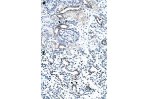 Immunohistochemical staining (Formalin-fixed paraffin-embedded sections) of human kidney (A) and human lung (B) with EVX1 polyclonal antibody  at 4-8 ug/mL working concentration. (EVX1 anticorps  (N-Term))