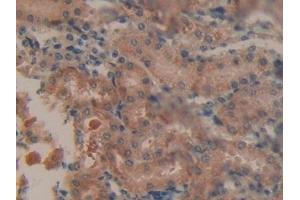 Detection of PDL1 in Mouse Kidney Tissue using Polyclonal Antibody to Programmed Cell Death Protein 1 Ligand 1 (PDL1)