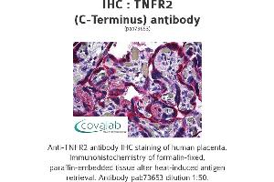 Image no. 1 for anti-Tumor Necrosis Factor Receptor Superfamily, Member 1B (TNFRSF1B) (C-Term) antibody (ABIN1740187) (TNFRSF1B anticorps  (C-Term))
