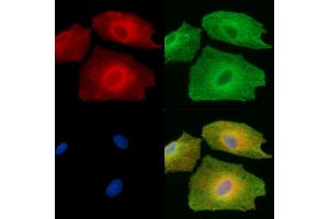anti-Chromosome 10 Open Reading Frame 90 (C10ORF90) antibody