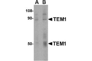 Western blot analysis of TEM1 in human colon tissue lysate with this product at (A) 0. (CD248 anticorps  (C-Term))
