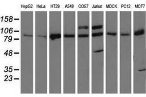Western blot analysis of extracts (35 µg) from 9 different cell lines by using anti-PRKD2 monoclonal antibody. (PKD2 anticorps)