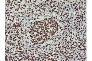 Image no. 4 for anti-Non-POU Domain Containing, Octamer-Binding (NONO) (AA 184-385) antibody (ABIN1491073) (NONO anticorps  (AA 184-385))