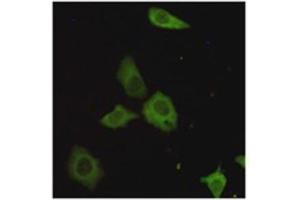 Immunocytochemistry staining of HeLa cells fixed with 4 % Paraformaldehyde and using TORC1 mouse mAb (dilution 1:200).