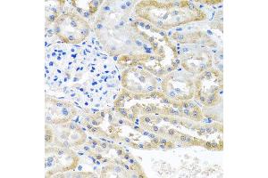 Immunohistochemistry of paraffin-embedded rat kidney using OGFR antibody at dilution of 1:100 (x40 lens). (OGFR anticorps)