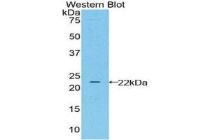 Western Blotting (WB) image for anti-Lipocalin 2 (LCN2) (AA 21-198) antibody (ABIN3206734) (Lipocalin 2 anticorps  (AA 21-198))