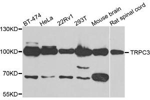 Western blot analysis of extracts of various cell lines, using TRPC3 antibody. (TRPC3 anticorps)
