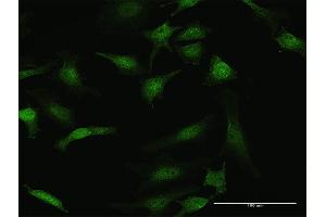 Immunofluorescence of purified MaxPab antibody to STK3 on HeLa cell.