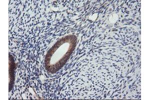 Image no. 7 for anti-Mitogen-Activated Protein Kinase Kinase 3 (MAP2K3) antibody (ABIN1499401)