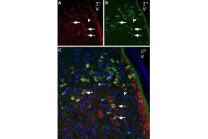 Multiplex staining of Melatonin receptor type 1B and NaV1. (Melatonin Receptor 1B anticorps  (AA 232-246))