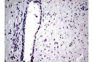 anti-Nibrin (NBN) (AA 183-460) antibody