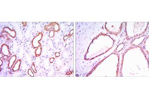 Immunohistochemical analysis of paraffin-embedded kidney tissues using HK1 mouse mAb with DAB staining. (Hexokinase 1 anticorps)