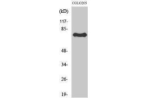 Western Blotting (WB) image for anti-Activating Transcription Factor 6 beta (ATF6B) (Internal Region) antibody (ABIN3183420) (ATF6B anticorps  (Internal Region))