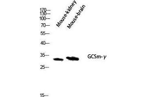 Western Blot (WB) analysis of Mouse Kidney Mouse Brain lysis using GCSm-gamma antibody. (GCSm-gamma (Internal Region) anticorps)