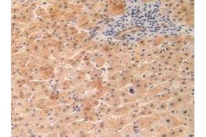 IHC-P analysis of Human Liver Tissue, with DAB staining. (OIT3 anticorps  (AA 297-506))
