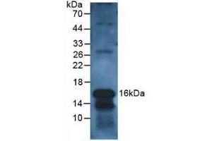 Detection of CLC in Human Leukocyte Cells using Polyclonal Antibody to Charcot Leyden Crystal Protein (CLC) (Galectin 10 anticorps  (AA 2-142))