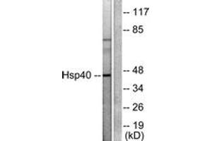 Western blot analysis of extracts from COLO205 cells, using HSP40 Antibody.