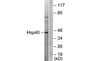 Western blot analysis of extracts from COLO205 cells, using HSP40 Antibody. (DNAJB1 anticorps  (AA 271-320))
