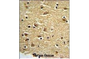 Formalin-fixed and paraffin-embedded human brain tissue reacted with PTK2 Antibody (C-term), which was peroxidase-conjugated to the secondary antibody, followed by DAB staining.