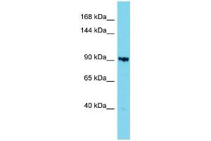 Host: Rabbit Target Name: KIAA1614 Sample Type: 721_B Whole Cell lysates Antibody Dilution: 1. (KIAA1614 anticorps  (C-Term))