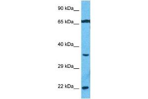 Host:  Rabbit  Target Name:  PEBB  Sample Type:  MCF7 Whole Cell lysates  Antibody Dilution:  1. (PEBB anticorps  (N-Term))