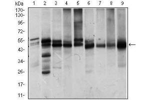 Western blot analysis using ILK mouse mAb against Jurkat (1), NIH3T3 (2), HeLa (3), PC-12 (4), C6 (5), COS7 (6), Raji (7), K562 (8) and MCF-7 (9) cell lysate. (ILK anticorps  (AA 97-244))