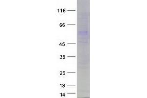 Validation with Western Blot