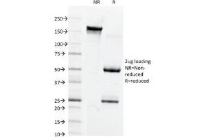 SDS-PAGE Analysis of Purified, BSA-Free Connexin 32 Antibody (clone M12. (GJB1 anticorps  (Cytoplasmic Loop))