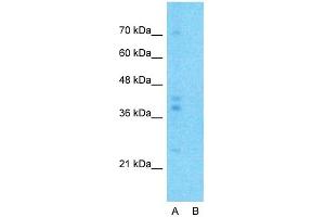 Host:  Rabbit  Target Name:  G6PC  Sample Type:  Human Fetal Lung  Lane A:  Primary Antibody  Lane B:  Primary Antibody + Blocking Peptide  Primary Antibody Concentration:  1ug/ml  Peptide Concentration:  5ug/ml  Lysate Quantity:  25ug/lane/lane  Gel Concentration:  0. (G6PC anticorps  (N-Term))