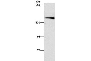 Western Blot analysis of Mouse brain tissue using ARHGEF11 Polyclonal Antibody at dilution of 1:1000