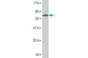 Western Blot detection against Immunogen (63. (STEAP1 anticorps  (AA 1-339))