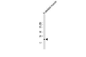 Anti-FNDC5 Antibody at 1:2000 dilution + human skeletal muscle lysate Lysates/proteins at 20 μg per lane. (FNDC5 anticorps  (AA 12-152))