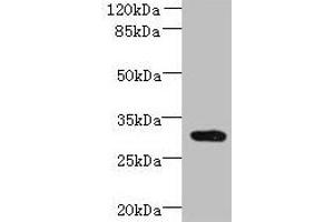 Western blot All lanes: CCDC127 antibody at 6 μg/mL + Mouse kidney tissue Secondary Goat polyclonal to rabbit IgG at 1/10000 dilution Predicted band size: 31 kDa Observed band size: 31 kDa (CCDC127 anticorps  (AA 1-260))