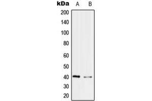 Western blot analysis of PRPF18 expression in Jurkat (A), MCF7 (B) whole cell lysates. (PRPF18 anticorps  (Center))