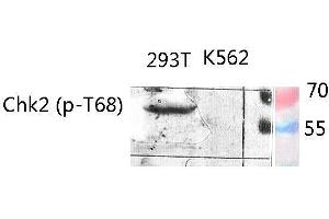 Western Blot (WB) analysis of specific lysis using Phospho-Chk2 (T68) Polyclonal Antibody. (CHEK2 anticorps  (pThr68))