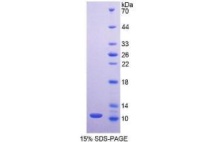 SDS-PAGE (SDS) image for Mucin 2, Oligomeric Mucus/gel-Forming (MUC2) (AA 27-110) protein (His tag) (ABIN1170963) (MUC2 Protein (AA 27-110) (His tag))