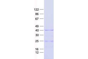 Validation with Western Blot