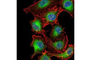 Immunofluorescence analysis of A549 cells using PDPK1 mouse mAb (green).