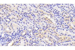 Detection of TNKS2 in Human Kidney Tissue using Polyclonal Antibody to Tankyrase 2 (TNKS2)