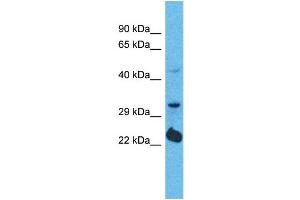 Western Blotting (WB) image for anti-Olfactory Receptor, Family 5, Subfamily D, Member 14 (OR5D14) (C-Term) antibody (ABIN2791753) (OR5D14 anticorps  (C-Term))